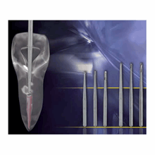 Endo bor - 700x700