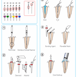 LUSCENT LYSLEDENDE STIFTER DENTATUS